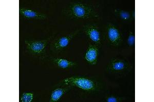 IF analysis of Calpastatin using anti-Calpastatin antibody (ABIN4886503).