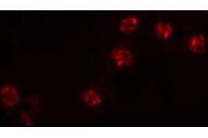 ABIN6274516 staining NIH-3T3 cells by IF/ICC. (ZNF287 抗体)