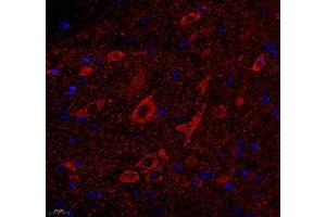 Immunofluorescence (Paraffin-embedded Sections) (IF (p)) image for anti-ATP Synthase, H+ Transporting, Mitochondrial F0 Complex, Subunit C1 (Subunit 9) (ATP5G1) antibody (ABIN7073141)
