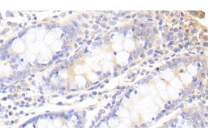 Detection of SNX9 in Human Colon Tissue using Polyclonal Antibody to Sorting Nexin 9 (SNX9) (SNX9 抗体  (AA 250-595))