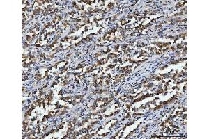 IHC analysis of Aconitase 2 using anti-Aconitase 2 antibody (ABIN7602770). (ACO2 抗体  (C-Term))