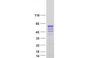 Western Blotting (WB) image for Cyclin-Dependent Kinase 16 (CDK16) (Transcript Variant 2) protein (Myc-DYKDDDDK Tag) (ABIN2713855)