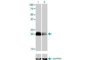 Western blot analysis of CITED1 over-expressed 293 cell line, cotransfected with CITED1 Validated Chimera RNAi (Lane 2) or non-transfected control (Lane 1). (CITED1 抗体  (AA 94-193))