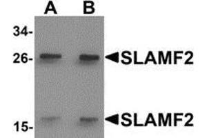 Western blot analysis of SLAMF2 in rat lung tissue lysate with SLAMF2 antibody at (A) 1 and (B) 2 μg/ml. (CD48 抗体  (Center))