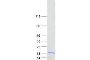 Western Blotting (WB) image for Synaptonemal Complex Central Element Protein 3 (SYCE3) protein (Myc-DYKDDDDK Tag) (ABIN2714114)