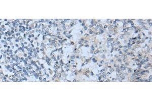 Immunohistochemistry of paraffin-embedded Human tonsil tissue using STARD4 Polyclonal Antibody at dilution of 1:50(x200) (STARD4 抗体)