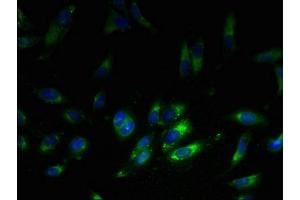 Immunofluorescent analysis of Hela cells using ABIN7142817 at dilution of 1:100 and Alexa Fluor 488-congugated AffiniPure Goat Anti-Rabbit IgG(H+L) (RPL38 抗体  (AA 1-70))