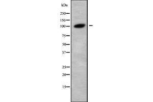 Western blot analysis Glucosidase II alpha using LOVO whole cell lysates (GANAB 抗体  (Internal Region))