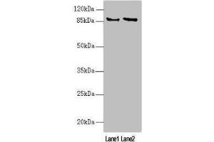 Western blot All lanes: MAPK8IP2 antibody at 2. (IB2 抗体  (AA 470-570))