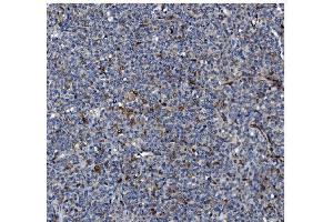 IHC analysis of GSDMD using anti-GSDMD antibody (ABIN7599432).