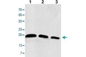 Western blot analysis of the extracts of Jurkat cells Lane 1: 30 ug, Lane 2: 20 ug, Lane 3: 10 ug with RAC2 monoclonal antibody, clone AT2G11  at 1:1000 dilution. (RAC2 抗体  (AA 1-189))