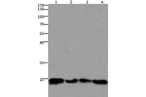 Western Blot analysis of 293T and hela cell, Mouse lung and brain tissue using HMGB3 Polyclonal Antibody at dilution of 1:400 (HMGB3 抗体)