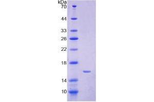 SDS-PAGE analysis of Human Hepcidin Protein. (Hepcidin 蛋白)