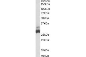 Western Blotting (WB) image for anti-rho Guanine Nucleotide Exchange Factor (GEF) 40 (ARHGEF40) (Middle Region) antibody (ABIN2156393) (ARHGEF40 抗体  (Middle Region))