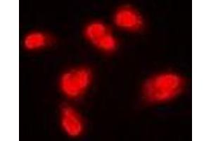 Immunofluorescent analysis of SPHK1 staining in Hela cells. (SPHK1 抗体)