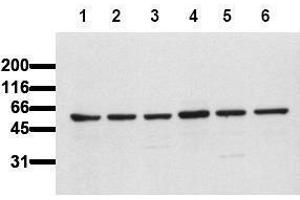 Western Blotting (WB) image for anti-V-Akt Murine Thymoma Viral Oncogene Homolog 1 (AKT1) (AA 466-480) antibody (ABIN126858) (AKT1 抗体  (AA 466-480))