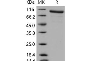 Western Blotting (WB) image for Matrix Metallopeptidase 9 (Gelatinase B, 92kDa Gelatinase, 92kDa Type IV Collagenase) (MMP9) protein (ABIN7320233) (MMP 9 蛋白)