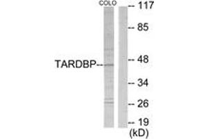 Western blot analysis of extracts from COLO205 cells, using TBX1 Antibody. (T-Box 1 抗体  (AA 311-360))