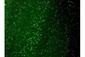 Immunohistochemistry (IHC) image for anti-Transient Receptor Potential Cation Channel, Subfamily V, Member 3 (TRPV3) (AA 774-791) antibody (ABIN361778)