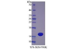 SDS-PAGE analysis of Mouse OTOR Protein. (Otoraplin Protein (OTOR))