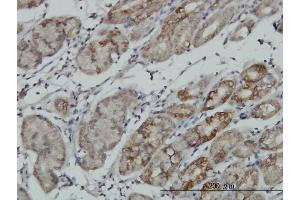 Immunoperoxidase of monoclonal antibody to RPS6KA6 on formalin-fixed paraffin-embedded human stomach.