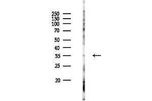 Western blot analysis of lysates from PC12 cells(UV 30 min treatment), using OR3 Antibody at 1/1000 dilution.