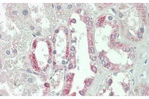 Detection of JAG1 in Human Kidney Tissue using Polyclonal Antibody to Jagged 1 (JAG1) (JAG1 抗体  (AA 836-1047))