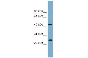 WB Suggested Anti-FLJ25439 Antibody Titration: 0. (TTC23L 抗体  (N-Term))