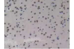 IHC-P analysis of Mouse Brain Tissue, with DAB staining. (CCL8 抗体  (AA 20-94))