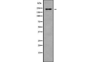 Western blot analysis of PTPRB using HuvEc whole cell lysates (PTPRB 抗体  (N-Term))