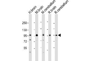 All lanes : Anti-DLG4 Antibody (C-erm) at 1:2000 dilution Lane 1: human brain lysate Lane 2: mouse brain lysate Lane 3: mouse cerebellum lysate Lane 4: rat brain lysate Lane 5: rat cerebellum lysate Lysates/proteins at 20 μg per lane. (DLG4 抗体  (AA 548-579))