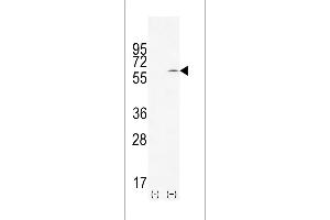 Western blot analysis of TIEG using rabbit polyclonal TIEG Antibody using 293 cell lysates (2 ug/lane) either nontransfected (Lane 1) or transiently transfected (Lane 2) with the TIEG gene. (KLF10/TIEG1 抗体  (AA 198-225))