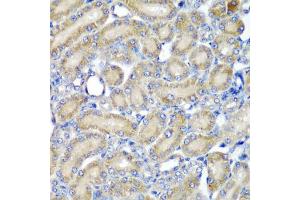 Immunohistochemistry of paraffin-embedded rat kidney using PDCD6 antibody (ABIN5974030) at dilution of 1/200 (40x lens). (PDCD6 抗体)