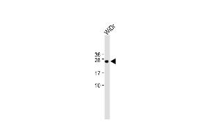 All lanes : Anti-C9orf95 Antibody (N-term) at 1:1000 dilution Lane 1: WiDr whole cell lysate Lysates/proteins at 20 μg per lane. (NMRK1 抗体  (N-Term))