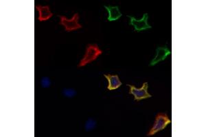 ABIN6257693 and ABIN6274606 staining Hela cells by IF/ICC.
