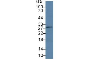 Western Blot; Sample: Mouse Lymph node lysate; Primary Ab: 3µg/ml Rabbit Anti-Human LAT Antibody Second Ab: 0. (LAT 抗体  (AA 25-221))