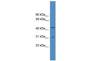 Western Blot showing OTUD6A antibody used at a concentration of 1-2 ug/ml to detect its target protein. (OTUD6A 抗体  (Middle Region))