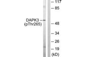 Western blot analysis of extracts from HuvEc cells, using DAPK3 (Phospho-Thr265) Antibody. (DAPK3 抗体  (pThr265))