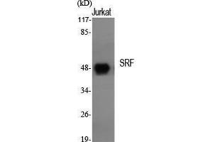 Western Blotting (WB) image for anti-Serum Response Factor (SRF) (Tyr118) antibody (ABIN3187054) (SRF 抗体  (Tyr118))