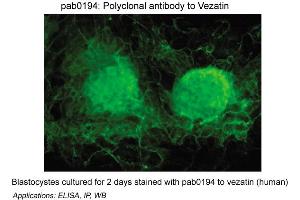 Image no. 1 for anti-Vezatin, Adherens Junctions Transmembrane Protein (VEZT) antibody (ABIN347059) (VEZT 抗体)