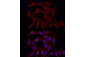Immunofluorescence (IF) image for anti-Sterol Regulatory Element Binding Transcription Factor 1 (SREBF1) (AA 1-100) antibody (ABIN7270598)