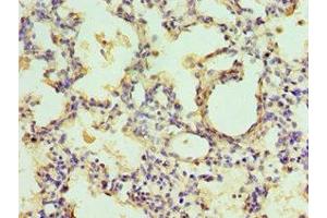 Immunohistochemistry of paraffin-embedded human lung tissue using ABIN7151443 at dilution of 1:100 (EGLN1 抗体  (AA 301-426))