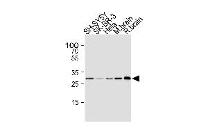 Western blot analysis of lysates from SH-SY5Y, SK-BR-3, Hela cell line, mouse brain and rat brain tissue lysate(from left to right), using CDK5 Antibody (ABIN1945087 and ABIN2843647). (CDK5 抗体)