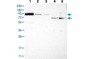 Western blot analysis of Lane 1: RT-4, Lane 2: U-251 MG, Lane 3: Human Plasma, Lane 4: Liver, Lane 5: Tonsil with FAM129B polyclonal antibody .
