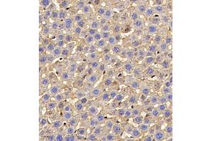 Immunohistochemistry of paraffin embedded rat liver using AHSG (ABIN7073021) at dilution of 1:700 (400x lens) (Fetuin A 抗体)