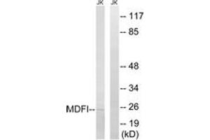 Western blot analysis of extracts from Jurkat cells, using MDFI Antibody. (MDFI 抗体  (AA 103-152))