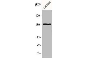Western Blotting (WB) image for anti-Junction Mediating and Regulatory Protein, P53 Cofactor (JMY) (C-Term) antibody (ABIN7185068)