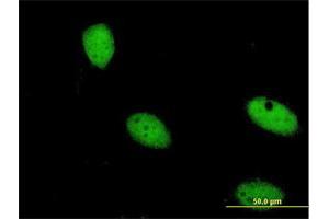 Immunofluorescence of monoclonal antibody to ZNF274 on HeLa cell. (ZNF274 抗体  (AA 420-530))
