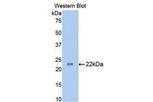 Western Blotting (WB) image for anti-Slit Homolog 1 (SLIT1) (AA 611-791) antibody (ABIN1860575) (SLIT1 抗体  (AA 611-791))