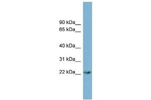 WB Suggested Anti-PERP  Antibody Titration: 0. (PERP 抗体  (Middle Region))